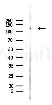 UBE4A Antibody - Western blot analysis of lysates from Mouse liver, using UBE4A Antibody at 1/1000 dilution.