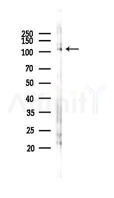 Phospho-Retinoblastoma (Thr826) Antibody - Western blot analysis of lysates from K562 cells(UV 30min treatment), using Phospho-Retinoblastoma (Thr826) Antibody at 1/1000 dilution.