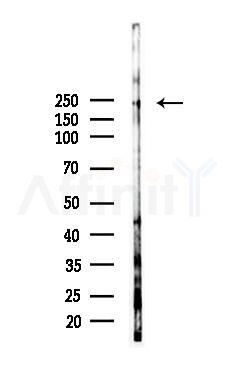 MAP4 Antibody - Western blot analysis of lysates from HUVEC cells(starvation 24h treatment), using MAP4 Antibody at 1/1000 dilution.