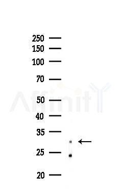 C/EBP epsilon Antibody - Western blot analysis of lysates from Rat brain, using C/EBP epsilon Antibody at 1/1000 dilution.
