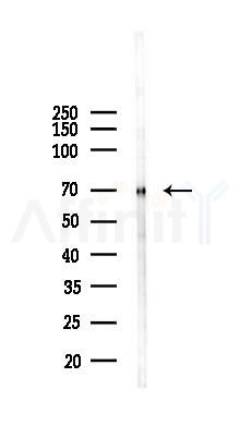 IL-2R beta/CD122 Antibody - Western blot analysis of lysates from Mouse testis, using IL-2R beta/CD122 Antibody at 1/1000 dilution.