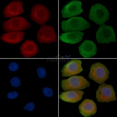 IL-2R beta/CD122 Antibody - AF0093 staining Hela cells(45min of heat-shock treatment) by IF/ICC.