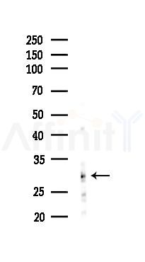 NOL3 Antibody - Western blot analysis of lysates from PC12 cells(LPS 4h treatment), using NOL3 Antibody at 1/1000 dilution.