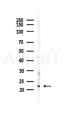 Bax Antibody - Western blot analysis of lysates from B16F10-LUC cells(LPS 4h treatment), using Bax Antibody at 1/1000 dilution.