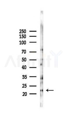 Bax Antibody - Western blot analysis of lysates from HUVEC cells(starvation 24h treatment), using Bax Antibody at 1/1000 dilution.