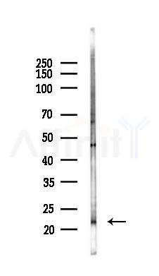 Claudin 2 Antibody - Western blot analysis of lysates from Rat lung, using Claudin 2 Antibody at 1/1000 dilution.