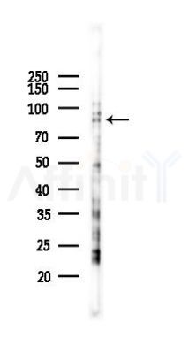 Cullin 2 Antibody - Western blot analysis of lysates from K562 cells(UV 30min treatment), using Cullin 2 Antibody at 1/1000 dilution.