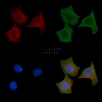 Desmin Antibody - AF0147 staining Hela cells(24h of starvation treatment) by IF/ICC.