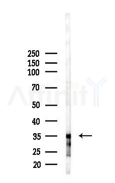 COL18A1 Antibody - Western blot analysis of lysates from HUVEC cells(starvation 24h treatment), using COL18A1 Antibody at 1/1000 dilution.