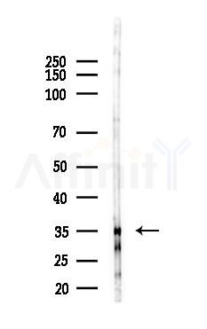 COL18A1 Antibody - Western blot analysis of lysates from EC304 cells(starvation 24h treatment), using COL18A1 Antibody at 1/1000 dilution.