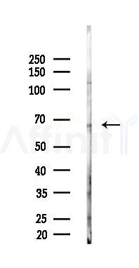 GAD1 Antibody - Western blot analysis of lysates from HUVEC cells(starvation,24h treatment), using GAD1 Antibody at 1/1000 dilution.