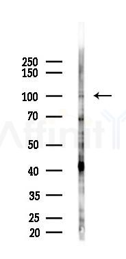 mGluR4 Antibody - Western blot analysis of lysates from EC304 cells(starvation,24h treatment), using mGluR4 Antibody at 1/1000 dilution.