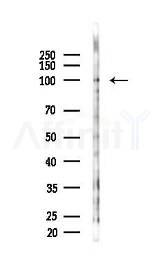 mGluR8 Antibody - Western blot analysis of lysates from EC304 cells(starvation 24h treatment), using mGluR8 Antibody at 1/1000 dilution.
