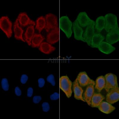 Grp75 Antibody - AF0176 staining Hela cells(24h of starvation treatment) by IF/ICC.