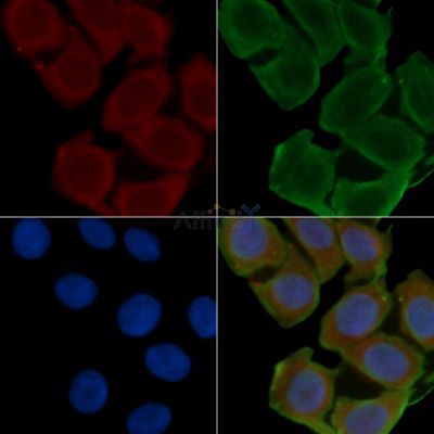 hCG beta Antibody - AF0177 staining Hela cells(24h of starvation treatment) by IF/ICC.