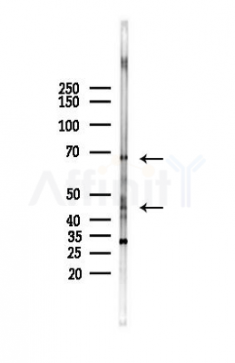 NRG1 Antibody - Western blot analysis of lysates from HepG2 cells(starvation,24h treatment), using NRG1 Antibody at 1/1000 dilution.
