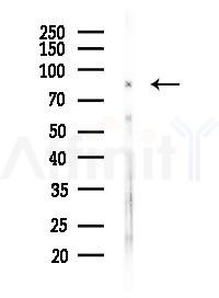 MMP15 Antibody - Western blot analysis of lysates from Rat brain, using MMP15 Antibody at 1/1000 dilution.