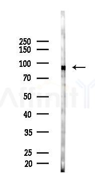 OCT1 Antibody - Western blot analysis of lysates from EC304 cells(starvation,24h treatment), using OCT1 Antibody at 1/1000 dilution.