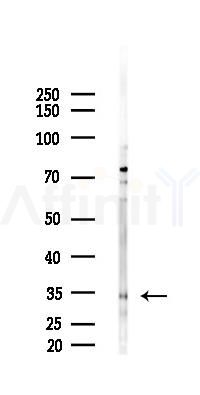 KLK3 Antibody - Western blot analysis of lysates from EC304 cells(starvation,24h treatment), using KLK3 Antibody at 1/1000 dilution.