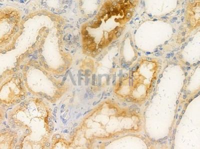 SHIP1 Antibody - AF0252 at 1/100 staining human normal kidney tissue by IHC-P.
