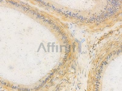 SHIP1 Antibody - AF0252 at 1/100 staining human testicular cancer by IHC-P.
