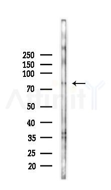 Sumo1 Antibody - Western blot analysis of lysates from HUVEC cells(starvation 24h treatment), using Sumo1 Antibody at 1/1000 dilution.
