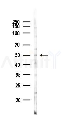 TNF Receptor I Antibody - Western blot analysis of lysates from B16F10-LUC cells(heat-shock 45min treatment), using TNF Receptor I Antibody at 1/1000 dilution.