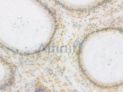 Ku70 Antibody - AF0300 at 1/100 staining human testicular cancer by IHC-P.