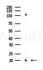 CDKA1 / DOC1 Antibody - Western blot analysis of lysates from B16F10-LUC cells(heat-shock 45min treatment), using CDKA1 / DOC1 Antibody at 1/1000 dilution.