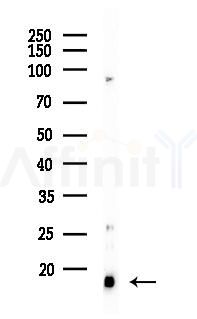 CDKA1 / DOC1 Antibody - Western blot analysis of lysates from PC12 cells(LPS 4h treatment), using CDKA1 / DOC1 Antibody at 1/1000 dilution.