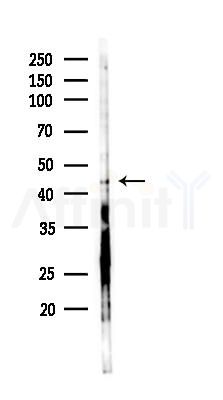 TBX1 Antibody - Western blot analysis of lysates from PC12 cells(LPS 4h treatment), using TBX1 Antibody at 1/1000 dilution.