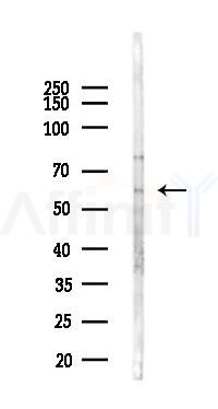 FOXJ1 Antibody - Western blot analysis of lysates from HUVEC cells(starvation,24h treatment), using FOXJ1 Antibody at 1/1000 dilution.