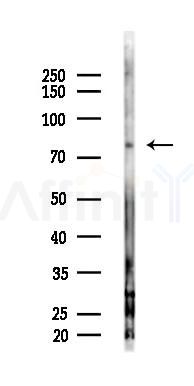 MTA1 Antibody - Western blot analysis of lysates from EC304 cells(starvation,24h treatment), using MTA1 Antibody at 1/1000 dilution.