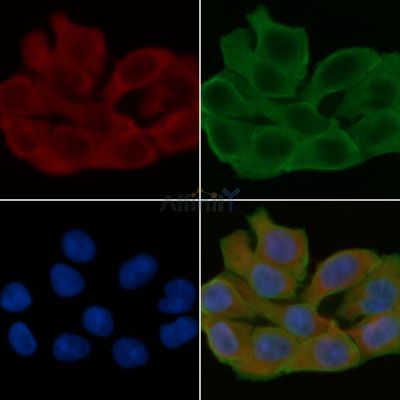 MAGI2 Antibody - AF0492 staining Hela cells(24h of starvation treatment) by IF/ICC.