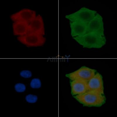ACTG2 Antibody - AF0520 staining Hela cells(24h of starvation treatment) by IF/ICC.