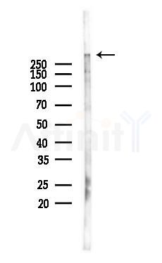 APC  Antibody - Western blot analysis of lysates from Mouse lung, using APC  Antibody at 1/1000 dilution.