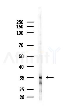 MORF4L1 Antibody - Western blot analysis of lysates from EC304 cells(starvation 24h treatment), using MORF4L1 Antibody at 1/1000 dilution.