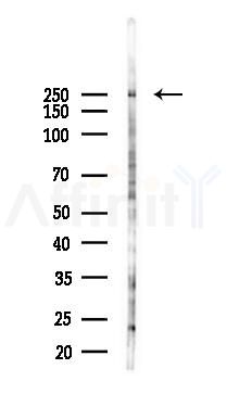 Collagen V  alpha 1 Antibody - Western blot analysis of lysates from PC12 cells(LPS 4h treatment), using Collagen V  alpha 1 Antibody at 1/1000 dilution.