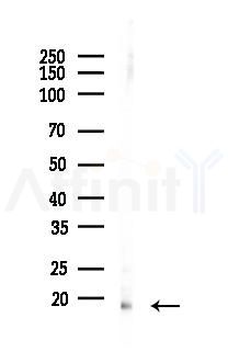 p18 INK4c Antibody - Western blot analysis of lysates from B16F10-LUC cells(heat-shock 45min treatment), using p18 INK4c Antibody at 1/1000 dilution.