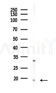p18 INK4c Antibody - Western blot analysis of lysates from PC12 cells(LPS 4h treatment), using p18 INK4c Antibody at 1/1000 dilution.