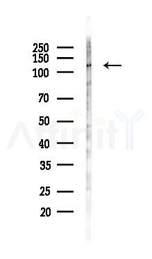 RBM26 Antibody - Western blot analysis of lysates from Rat lung, using RBM26 Antibody at 1/1000 dilution.