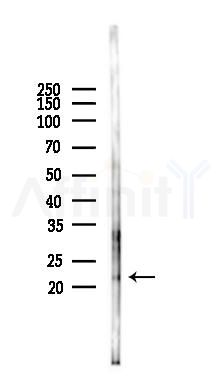 TPD54 Antibody - Western blot analysis of lysates from Mouse lung, using TPD54 Antibody at 1/1000 dilution.