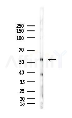 GAD1/2 Antibody - Western blot analysis of lysates from Mouse lung, using GAD1/2 Antibody at 1/1000 dilution.