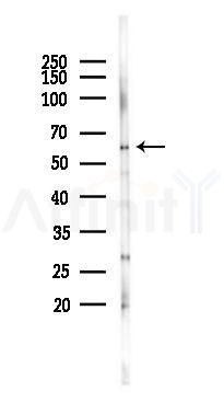 GK2 Antibody - Western blot analysis of lysates from Rat liver, using GK2 Antibody at 1/1000 dilution.