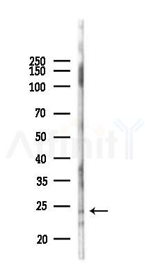 MOBL3 Antibody - Western blot analysis of lysates from B16F10-LUC cells(heat-shock 45min treatment), using MOBL3 Antibody at 1/1000 dilution.