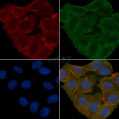 GRP78 Antibody - AF0729 staining Hela cells(24h of starvation treatment) by IF/ICC.