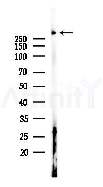 Collagen XII alpha 1 Antibody - Western blot analysis of lysates from Rat liver, using Collagen XII alpha 1 Antibody at 1/1000 dilution.