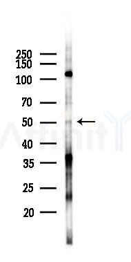 Cytokeratin 15 Antibody - Western blot analysis of lysates from K562 cells(UV 30min treatment), using Cytokeratin 15 Antibody at 1/1000 dilution.