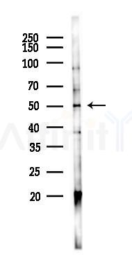 TRHR Antibody - Western blot analysis of lysates from K562 cells(UV 30min treatment), using TRHR Antibody at 1/1000 dilution.