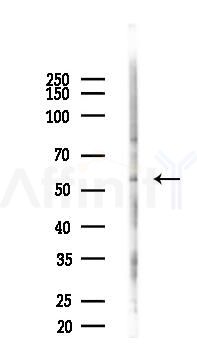 Glycerol kinase Antibody - Western blot analysis of lysates from HUVEC cells(starvation,24h treatment), using Glycerol kinase Antibody at 1/1000 dilution.